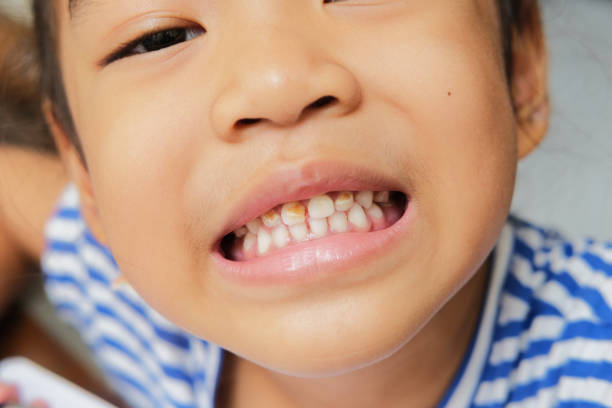 Signs Your Child Needs to See a Pediatric Dentist