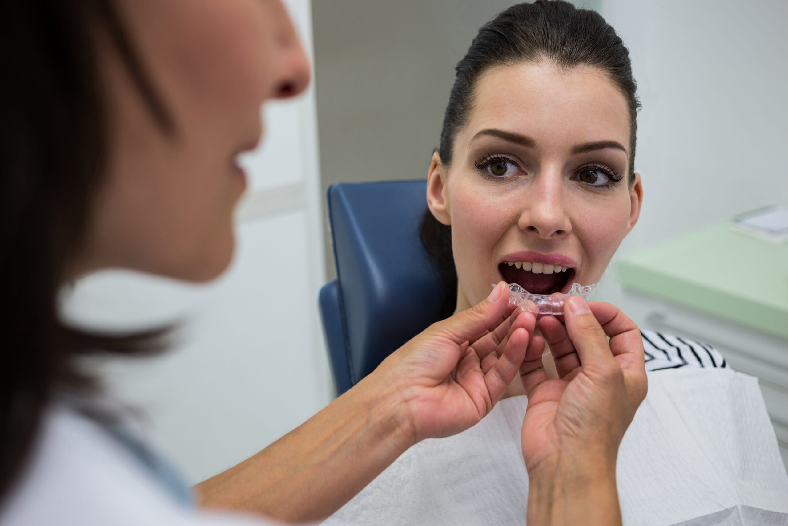Aligners Treatment Process