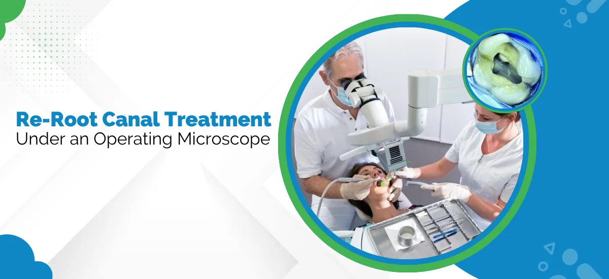 Re-Root_Canal_Treatment_Under_an_Operating_Microscope
