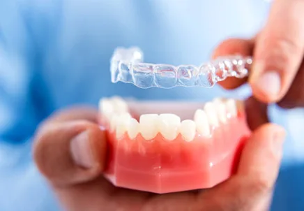 Orthodontic-Treatment