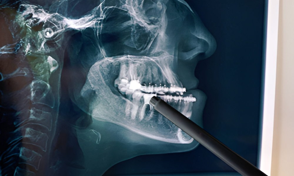 Oral & Maxillofacial Surgery