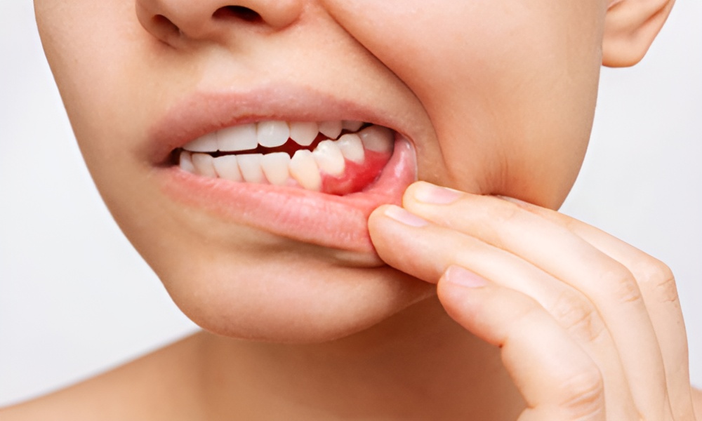 Gum Disease Treatment