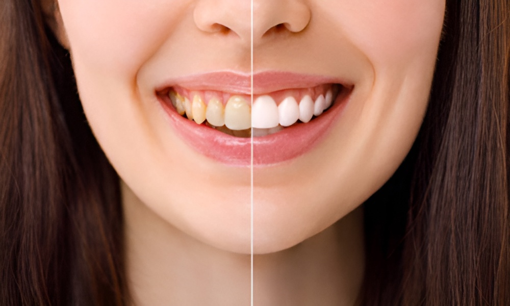 Cosmetic Dentistry