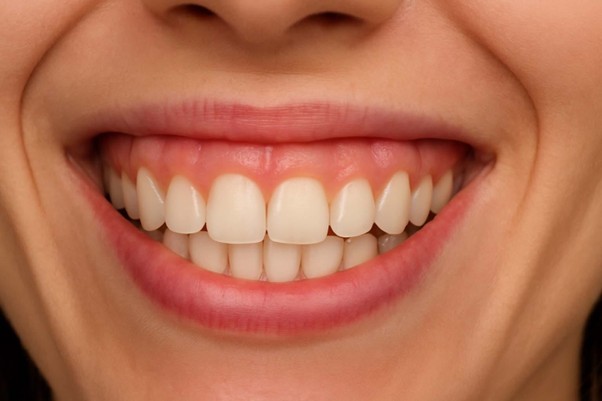 Close-up of a smiling mouth showing white teeth and pink gums.