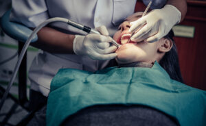 Teeth Grinding in Bangalore's IT Workers