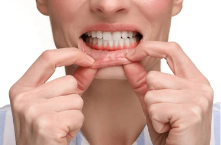 Close-up of a person pulling down their lower lip to reveal teeth and gums for dental illustration.